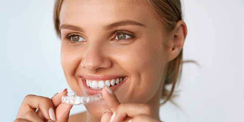 Straight Teeth in 6 Months